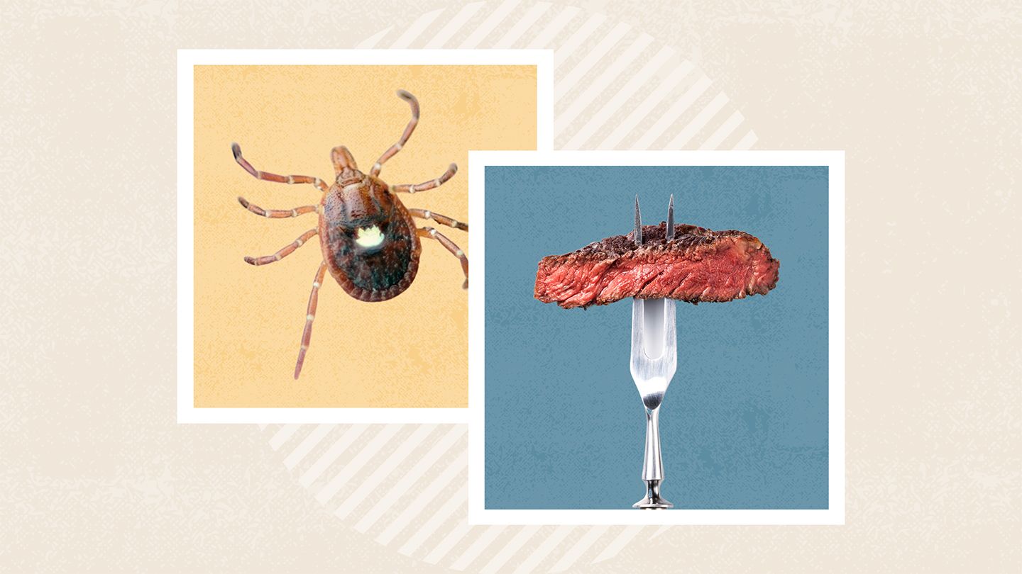 What You Need to Know About the Red Meat Allergy Caused by Tick Bites